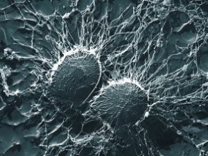 Staphylocoque doré Le bicarbonate de soude est-il désinfectant ou bactéricide ? Illustration Staphylocoque doré